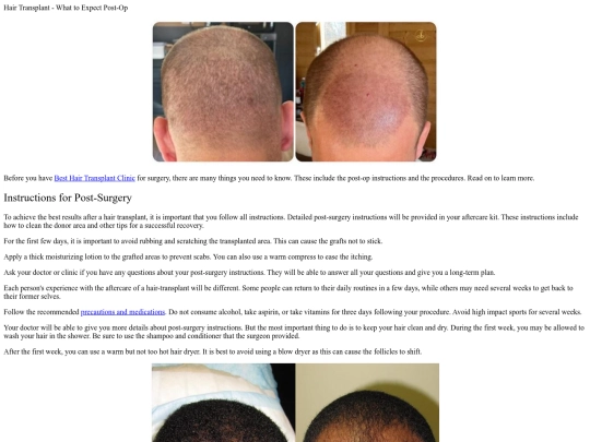 hairtransplant screenshot