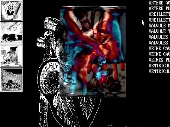 TENDRE ENUCLEATION screenshot